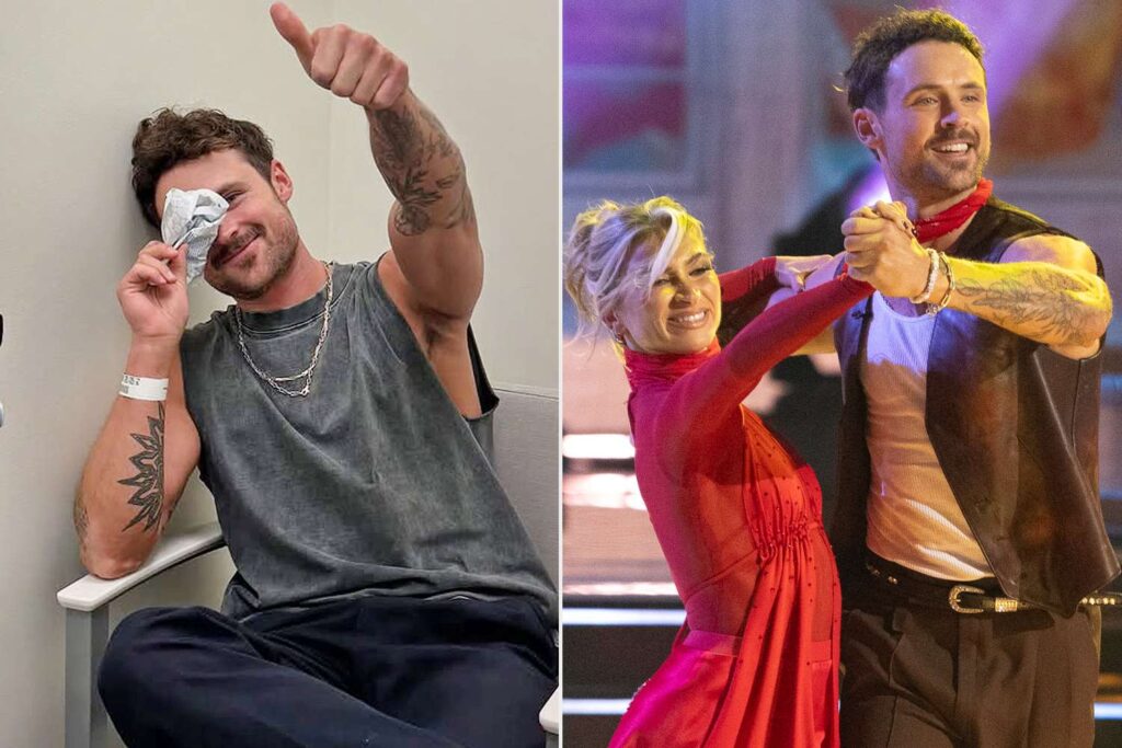 Dylan Efron reveals he broke his nose during ‘DWTS’ rehearsals