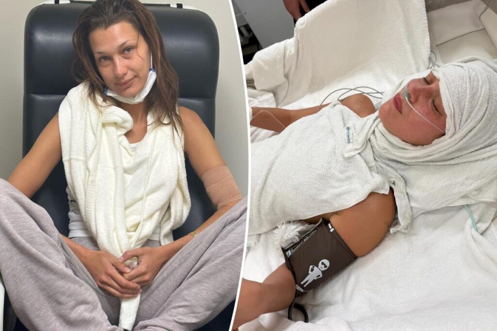 Bella Hadid opens up about ‘medical anxiety’ during battle with Lyme disease