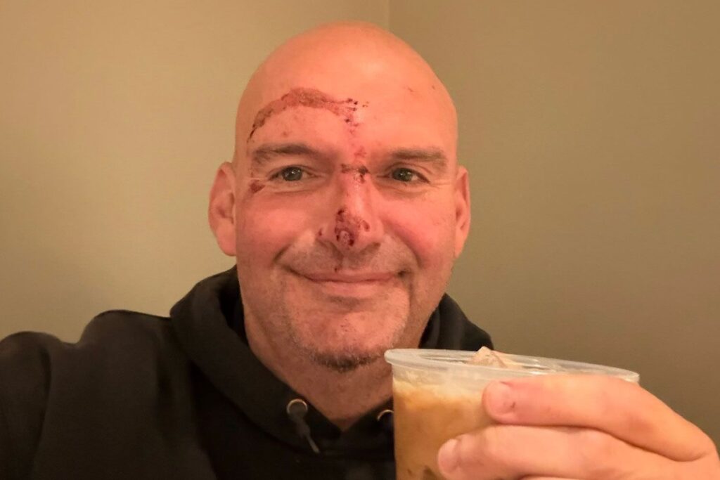 Sen. John Fetterman shares photo of stitches after falling and hospitalization