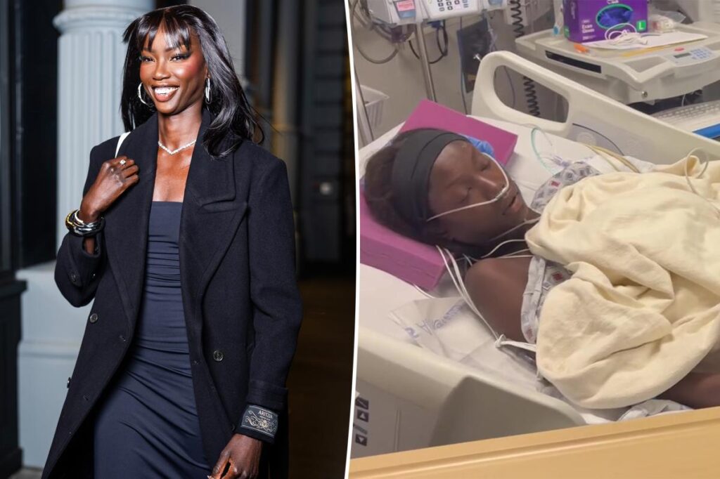 Supermodel Anok Yai, 28, undergoes ‘lifesaving treatment’ due to sepsis after lung surgery