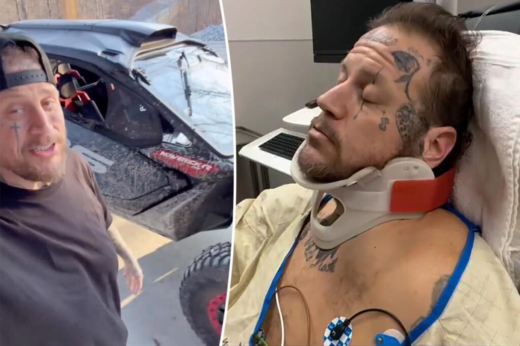 Jelly Roll was rushed to the hospital after flipping his ATV and causing a horrific accident.
