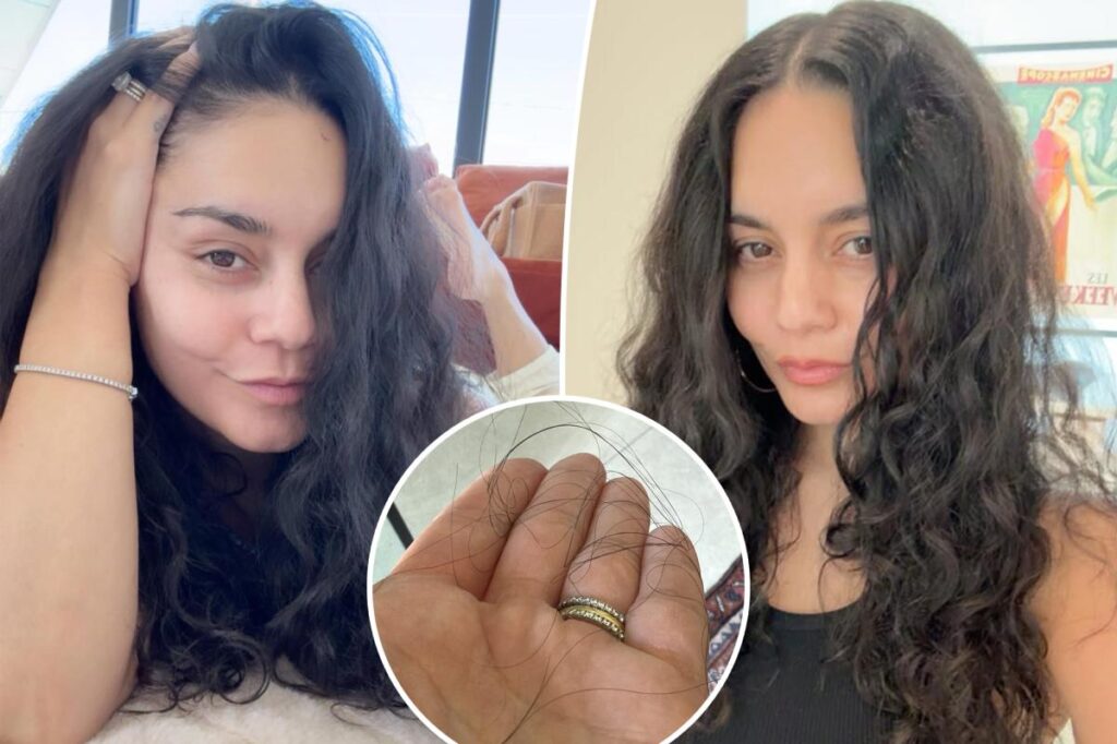 Vanessa Hudgens opens up about hair loss after giving birth to second child