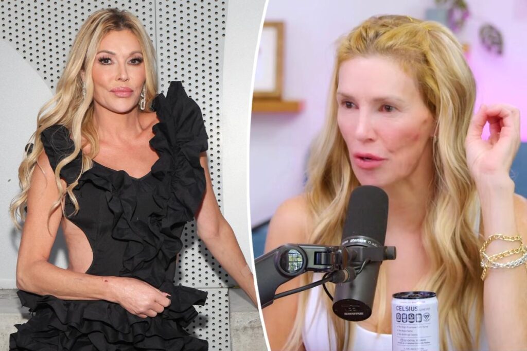 Brandi Glanville thinks she has ‘STI ringworm’ on her throat
