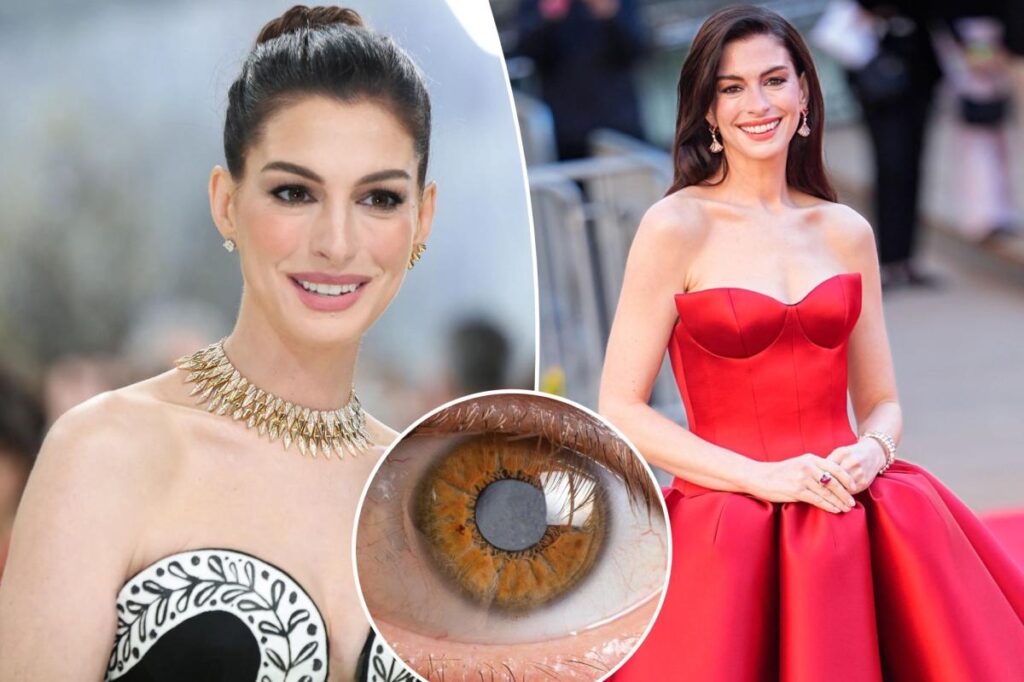 Anne Hathaway’s secret 10-year medical condition left her nearly blind throughout her 30s.