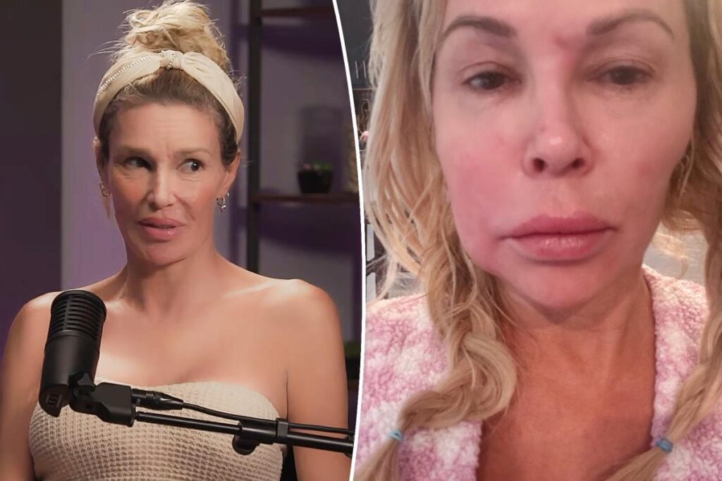 Brandi Glanville reveals latest health scare as face parasite problem rages on
