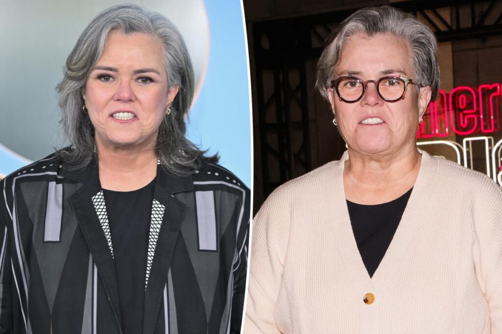 Rosie O’Donnell explains why she decided to reveal her secret facelift