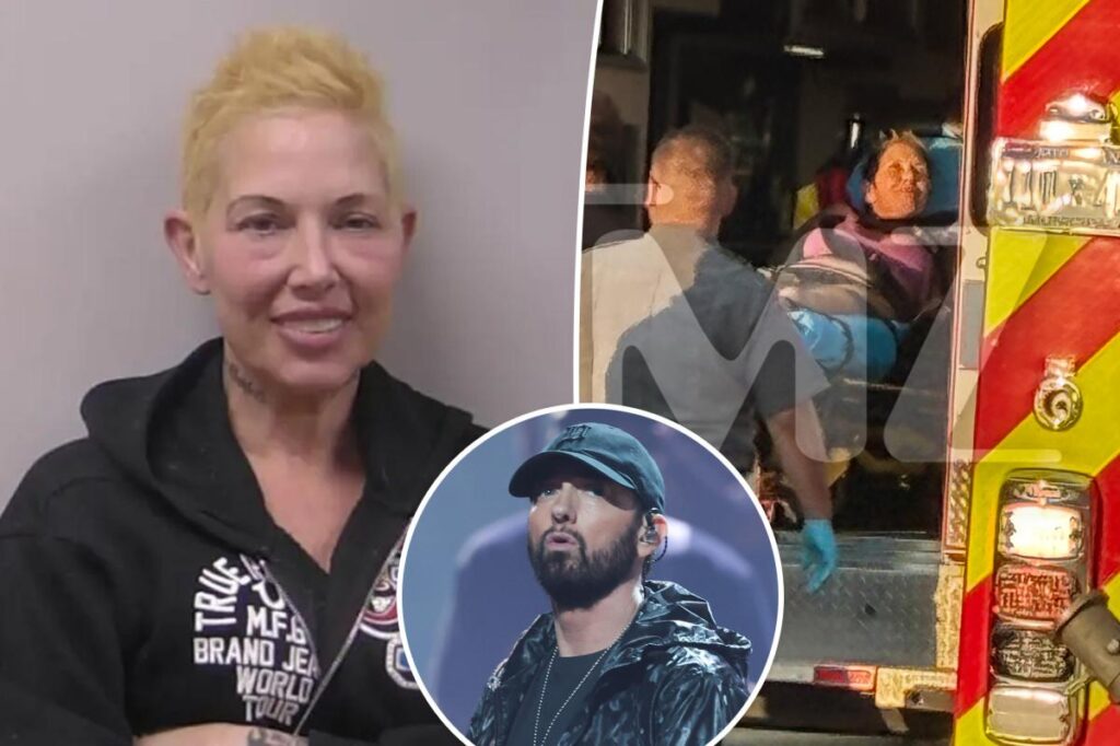 Eminem’s ex-wife Kim Scott rushed to hospital 2 months after DUI arrest